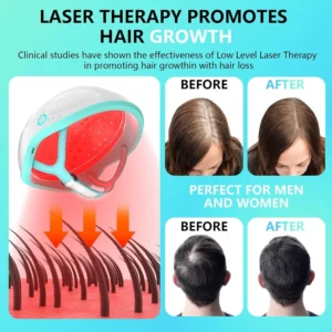 Wireless LLLT Hair Laser Cap